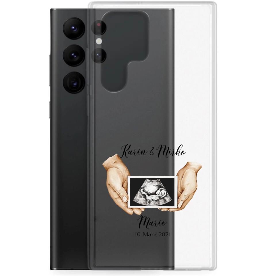 Ultraschall Bild - Personalisierbare Handyhülle