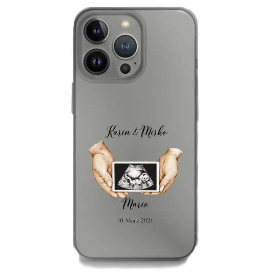iPhone Handyhülle mit personalisiertem Ultraschallbild und Namen – Einzigartiges Schwangerschaftsdesign.