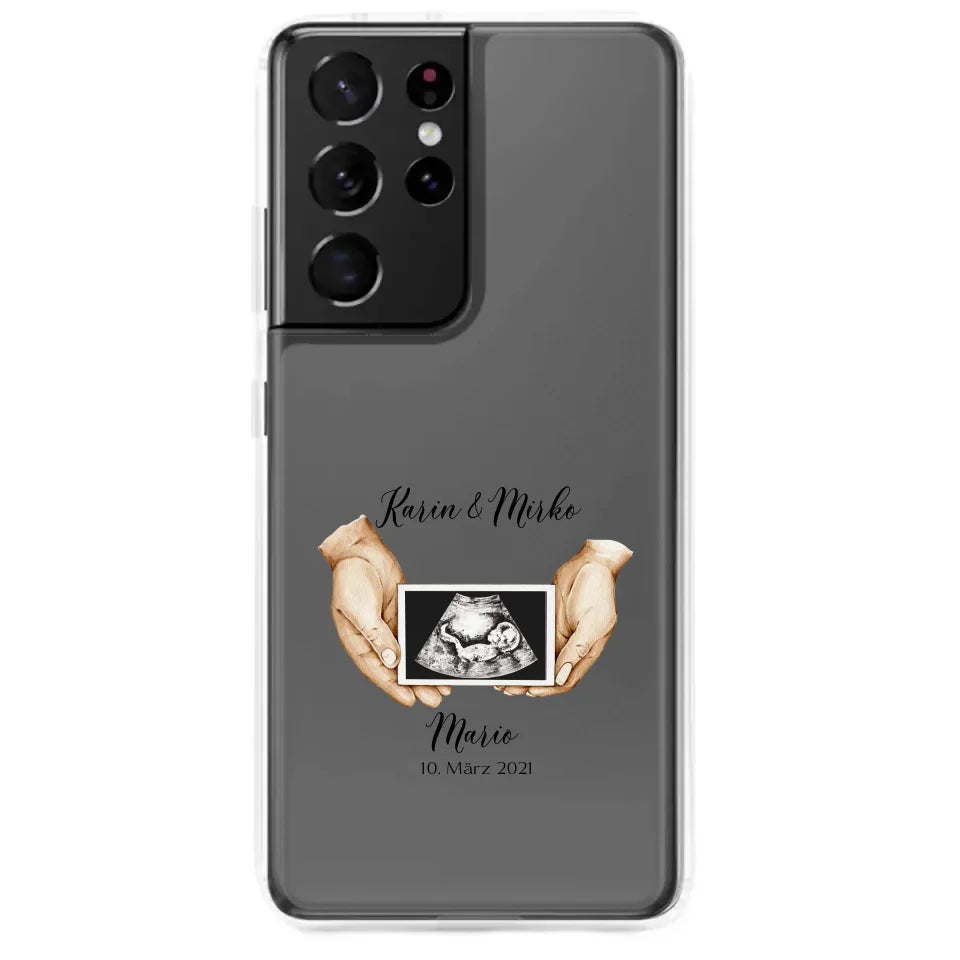Samsung Handyhülle mit individuellem Baby-Ultraschallbild, Namen und Datum – Perfektes Geschenk für Eltern